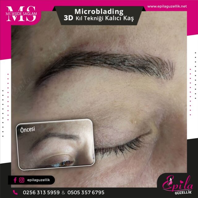 Nazilli - Microblading 3D Kıl Tekniği Kalıcı Kaş Kontürü