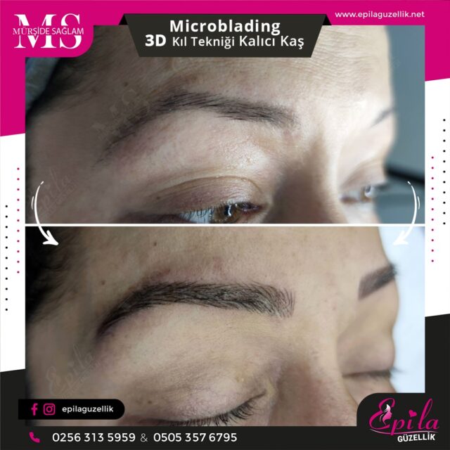 Nazilli - Microblading 3D Kıl Tekniği Kalıcı Kaş Kontürü