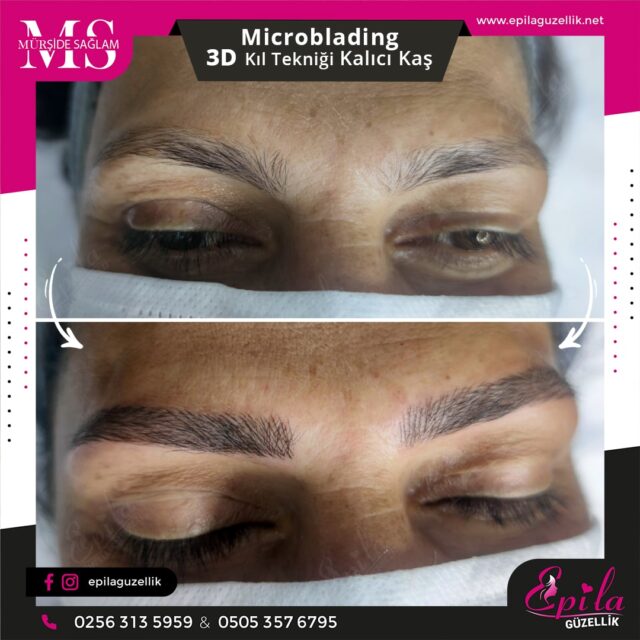 Nazilli - Microblading 3D Kıl Tekniği Kalıcı Kaş Kontürü