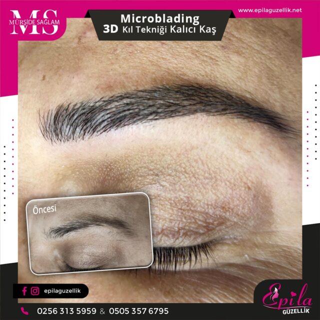 Nazilli - Microblading 3D Kıl Tekniği Kalıcı Kaş Kontürü