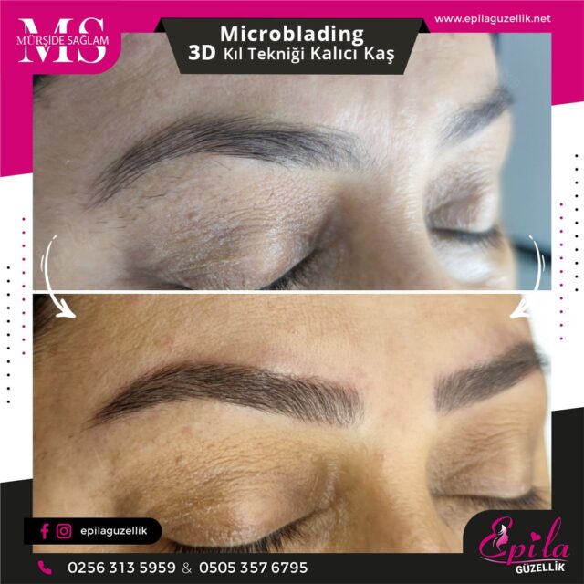 Nazilli - Microblading 3D Kıl Tekniği Kalıcı Kaş Kontürü