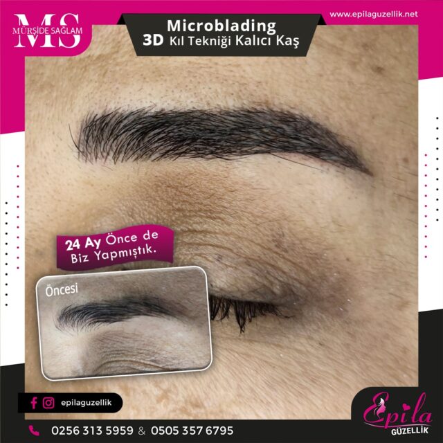 Nazilli - Microblading 3D Kıl Tekniği Kalıcı Kaş Kontürü