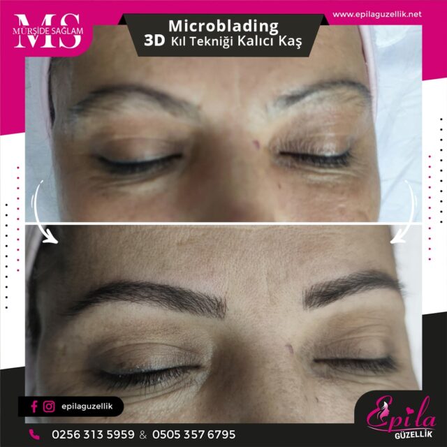 Nazilli - Microblading 3D Kıl Tekniği Kalıcı Kaş Kontürü