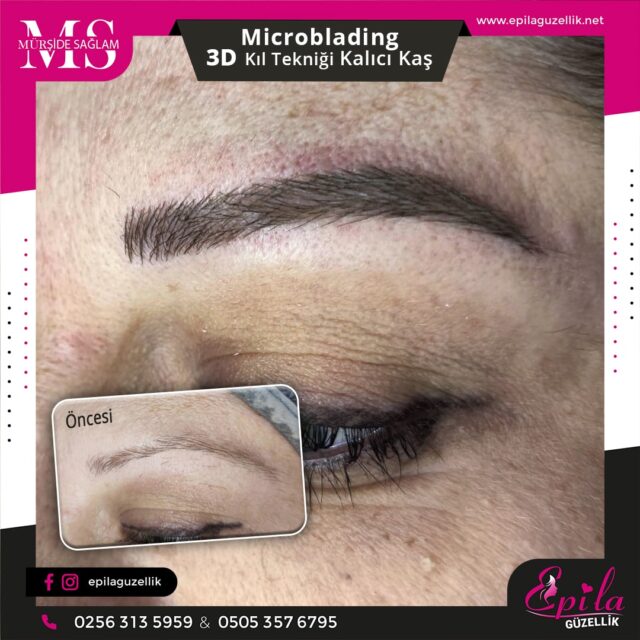 Nazilli - Microblading 3D Kıl Tekniği Kalıcı Kaş Kontürü