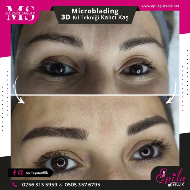 Nazilli - Microblading 3D Kıl Tekniği Kalıcı Kaş Kontürü