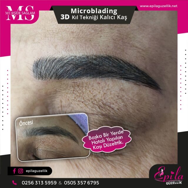 Nazilli - Microblading 3D Kıl Tekniği Kalıcı Kaş Kontürü