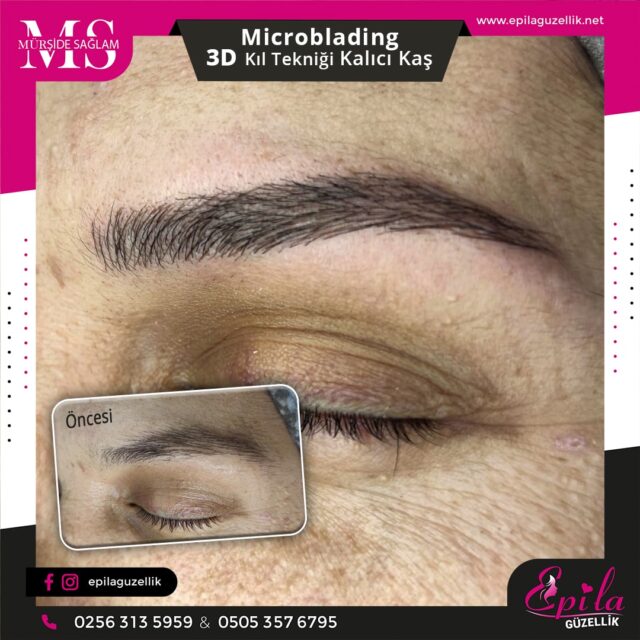 Nazilli - Microblading 3D Kıl Tekniği Kalıcı Kaş Kontürü