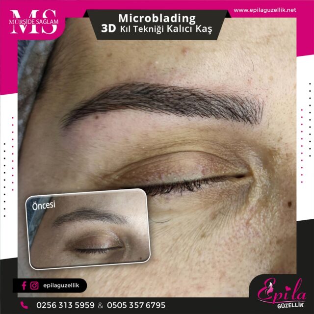 Nazilli - Microblading 3D Kıl Tekniği Kalıcı Kaş Kontürü