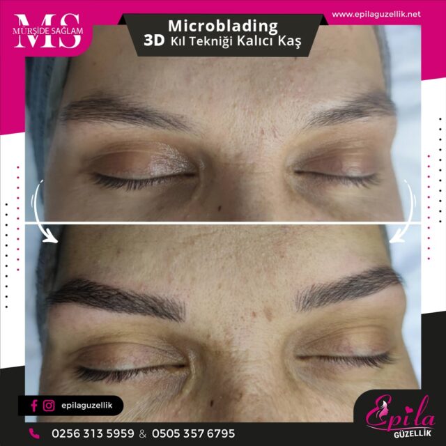 Nazilli - Microblading 3D Kıl Tekniği Kalıcı Kaş Kontürü