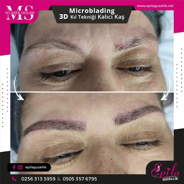 Nazilli - Microblading 3D Kıl Tekniği Kalıcı Kaş Kontürü