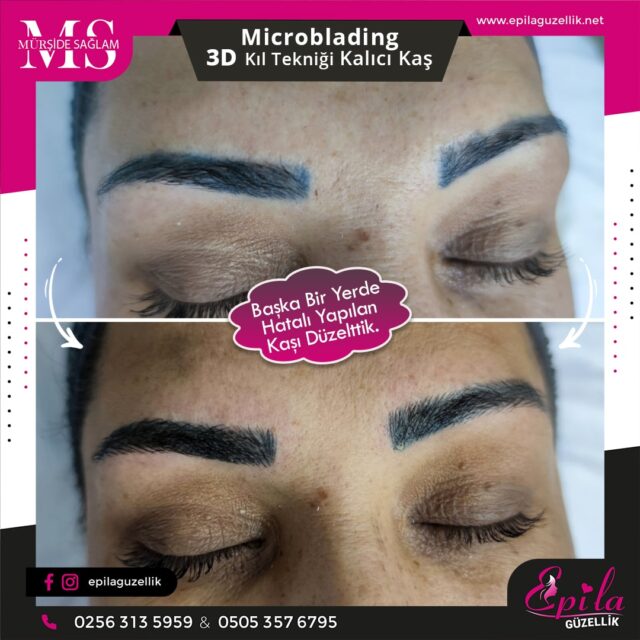 Nazilli - Microblading 3D Kıl Tekniği Kalıcı Kaş Kontürü