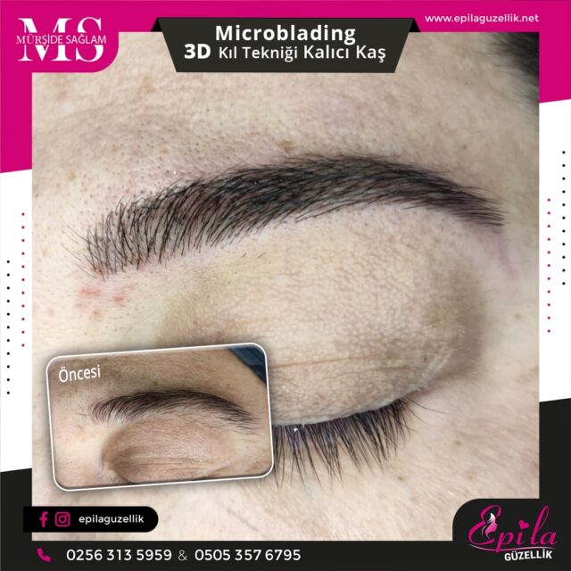 Nazilli - Microblading 3D Kıl Tekniği Kalıcı Kaş Kontürü