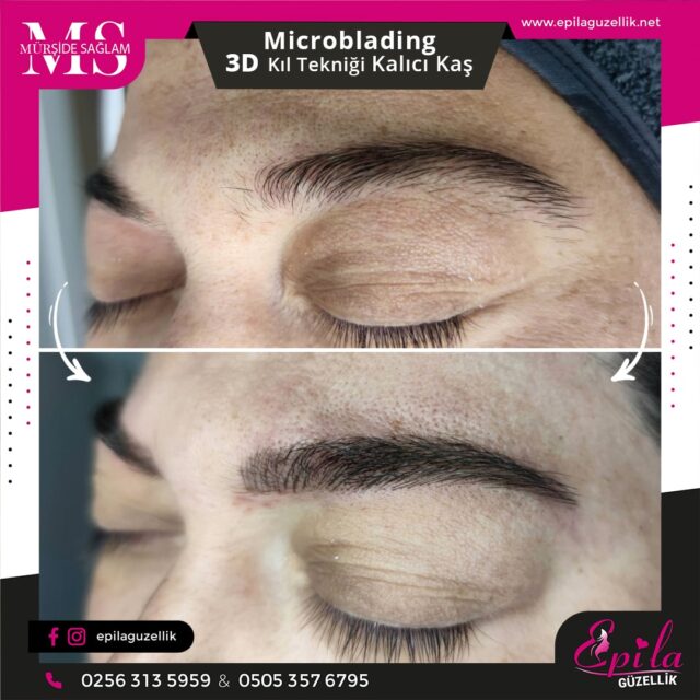 Nazilli - Microblading 3D Kıl Tekniği Kalıcı Kaş Kontürü