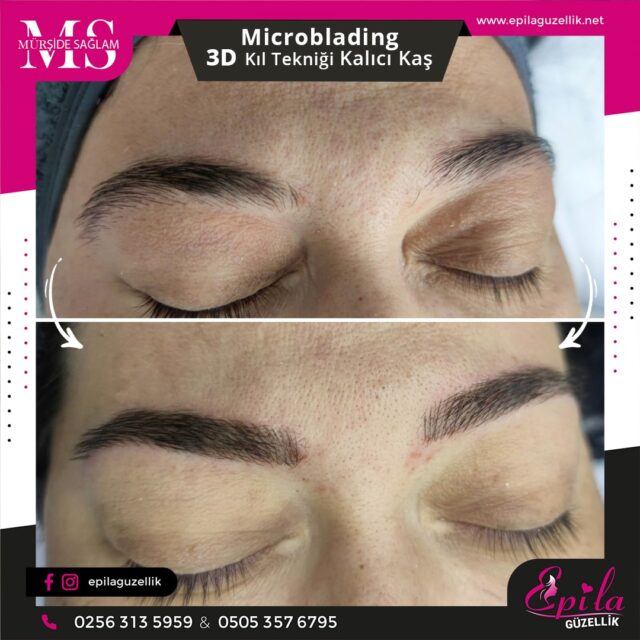 Nazilli - Microblading 3D Kıl Tekniği Kalıcı Kaş Kontürü