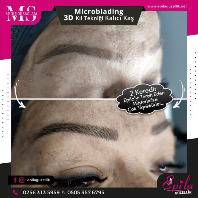 Nazilli - Microblading 3D Kıl Tekniği Kalıcı Kaş Kontürü