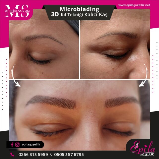 Nazilli - Microblading 3D Kıl Tekniği Kalıcı Kaş Kontürü