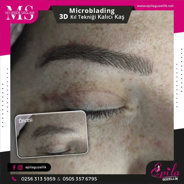 Nazilli - Microblading 3D Kıl Tekniği Kalıcı Kaş Kontürü