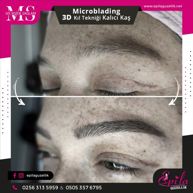 Nazilli - Microblading 3D Kıl Tekniği Kalıcı Kaş Kontürü