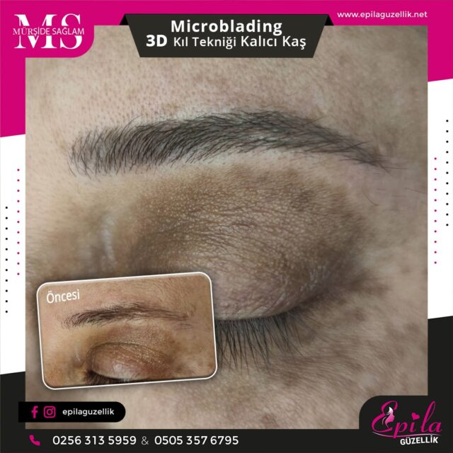 Nazilli - Microblading 3D Kıl Tekniği Kalıcı Kaş Kontürü