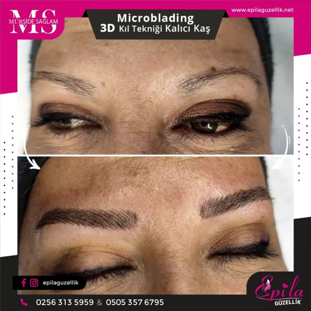 Nazilli - Microblading 3D Kıl Tekniği Kalıcı Kaş Kontürü