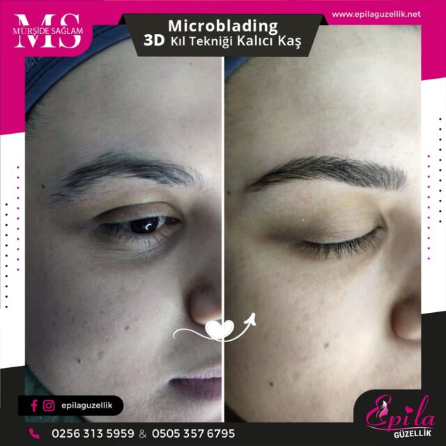 Nazilli - Microblading 3D Kıl Tekniği Kalıcı Kaş Kontürü