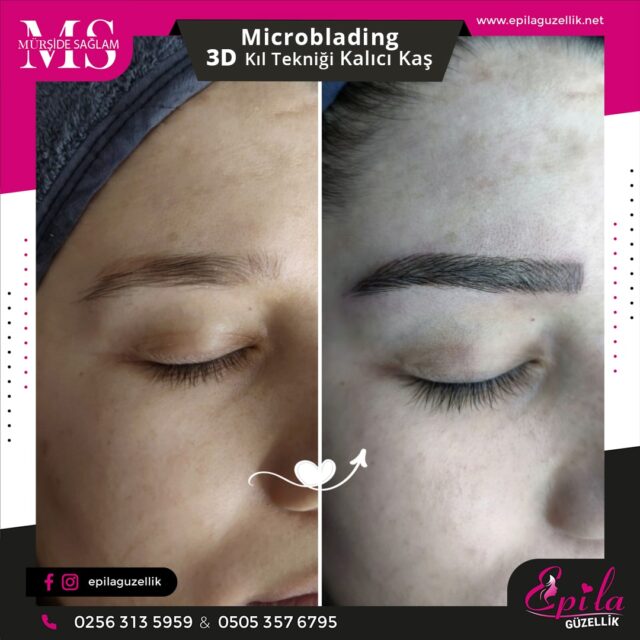 Nazilli - Microblading 3D Kıl Tekniği Kalıcı Kaş Kontürü