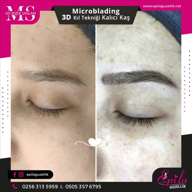 Nazilli - Microblading 3D Kıl Tekniği Kalıcı Kaş Kontürü