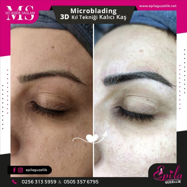 Nazilli - Microblading 3D Kıl Tekniği Kalıcı Kaş Kontürü