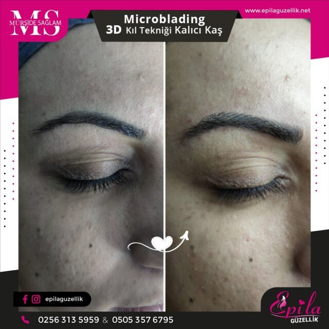 Nazilli - Microblading 3D Kıl Tekniği Kalıcı Kaş Kontürü