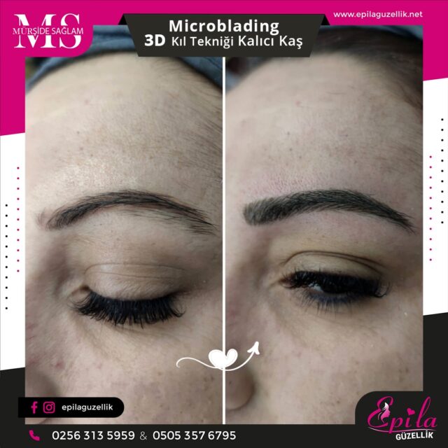 Nazilli - Microblading 3D Kıl Tekniği Kalıcı Kaş Kontürü