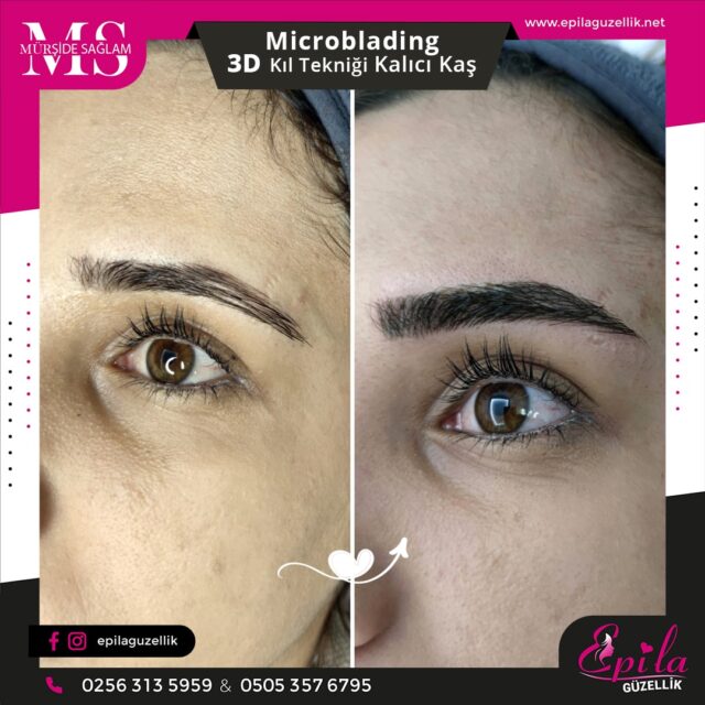 Nazilli - Microblading 3D Kıl Tekniği Kalıcı Kaş Kontürü