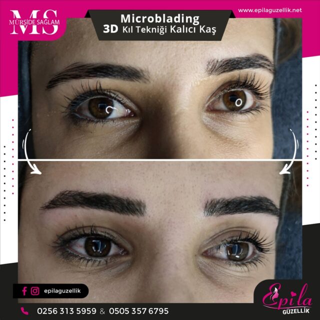 Nazilli - Microblading 3D Kıl Tekniği Kalıcı Kaş Kontürü