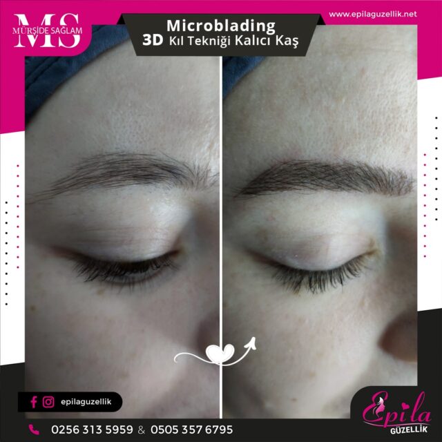 Nazilli - Microblading 3D Kıl Tekniği Kalıcı Kaş Kontürü