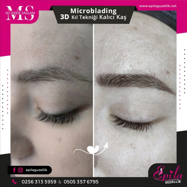 Nazilli - Microblading 3D Kıl Tekniği Kalıcı Kaş Kontürü