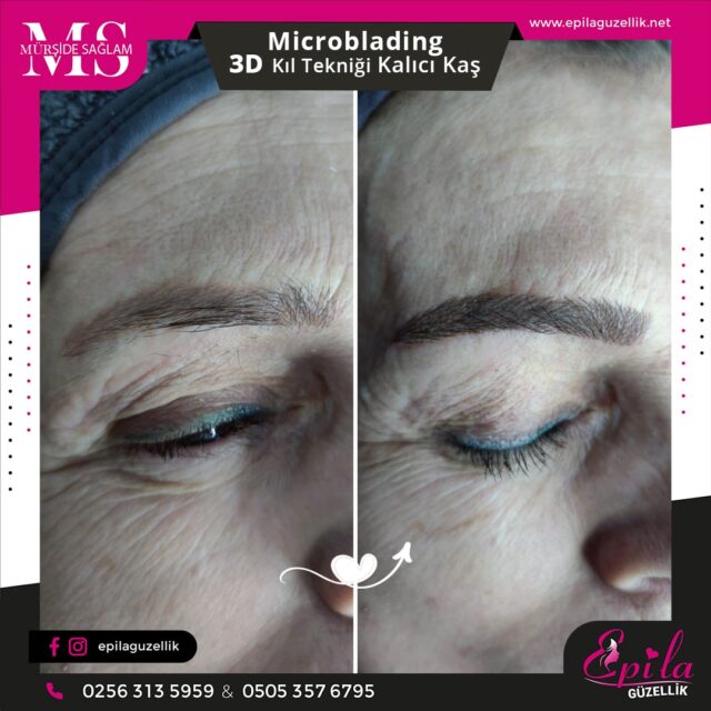 Nazilli - Microblading 3D Kıl Tekniği Kalıcı Kaş Kontürü