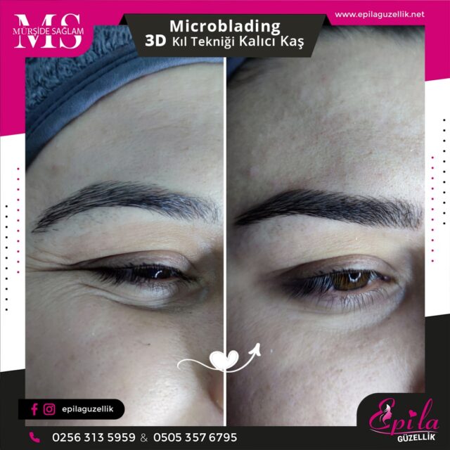 Nazilli - Microblading 3D Kıl Tekniği Kalıcı Kaş Kontürü