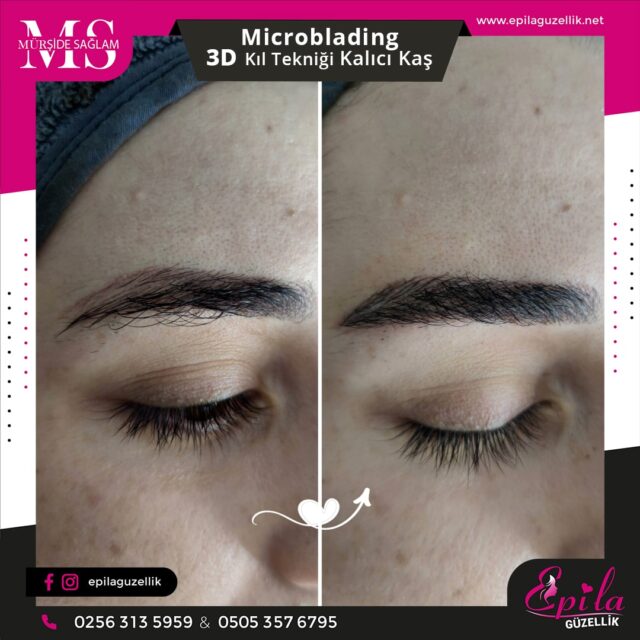 Nazilli - Microblading 3D Kıl Tekniği Kalıcı Kaş Kontürü