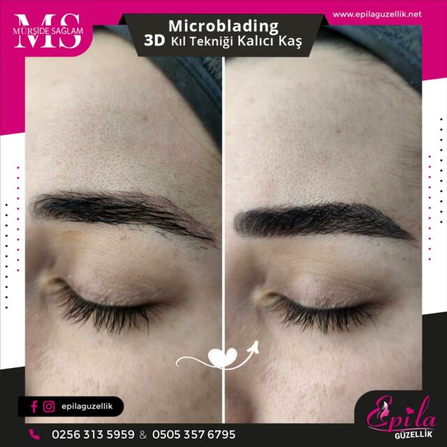 Nazilli - Microblading 3D Kıl Tekniği Kalıcı Kaş Kontürü