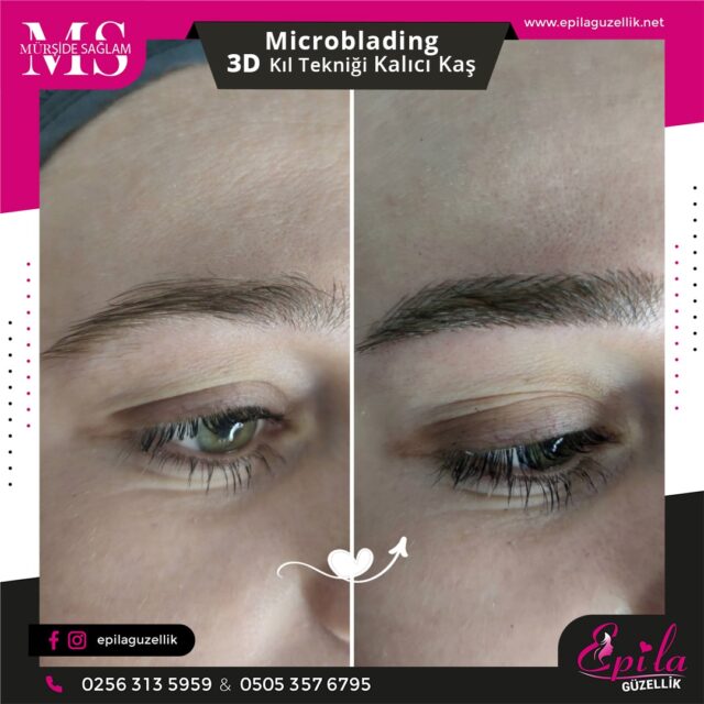 Nazilli - Microblading 3D Kıl Tekniği Kalıcı Kaş Kontürü