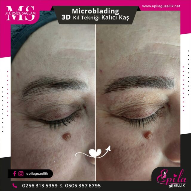 Nazilli - Microblading 3D Kıl Tekniği Kalıcı Kaş Kontürü