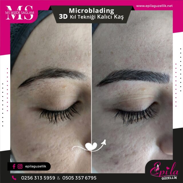 Nazilli - Microblading 3D Kıl Tekniği Kalıcı Kaş Kontürü