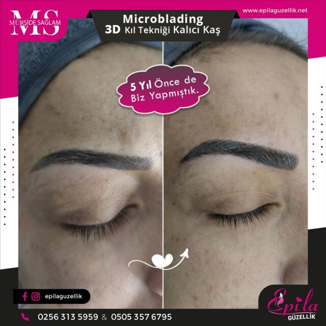 Nazilli - Microblading 3D Kıl Tekniği Kalıcı Kaş Kontürü