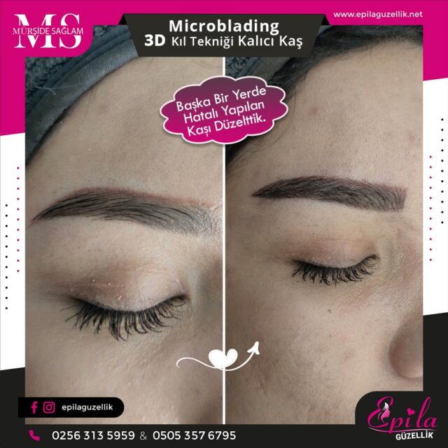 Nazilli - Microblading 3D Kıl Tekniği Kalıcı Kaş Kontürü