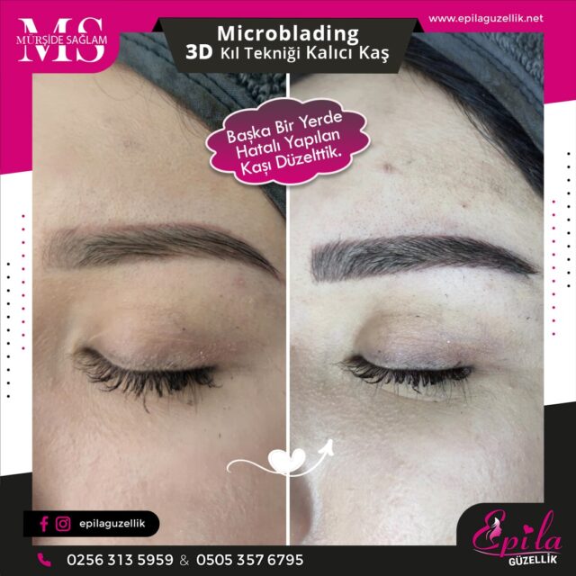 Nazilli - Microblading 3D Kıl Tekniği Kalıcı Kaş Kontürü