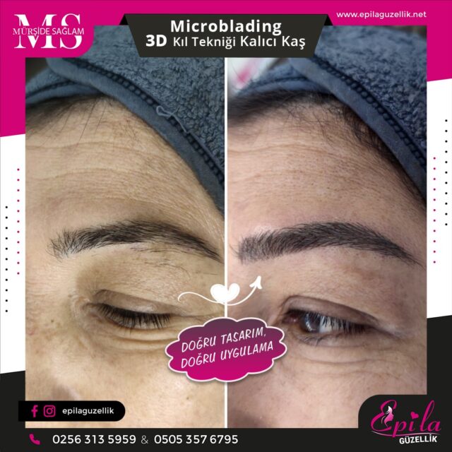 Nazilli - Microblading 3D Kıl Tekniği Kalıcı Kaş Kontürü