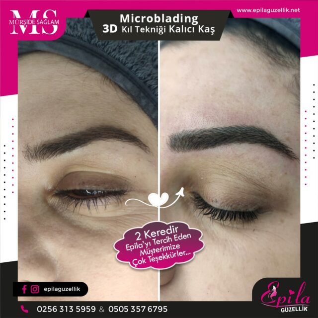 Nazilli - Microblading 3D Kıl Tekniği Kalıcı Kaş Kontürü