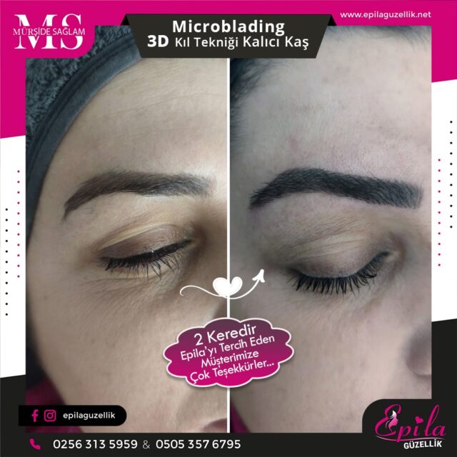 Nazilli - Microblading 3D Kıl Tekniği Kalıcı Kaş Kontürü