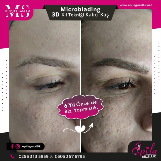 Nazilli - Microblading 3D Kıl Tekniği Kalıcı Kaş Kontürü