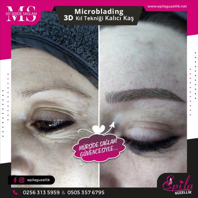 Nazilli - Microblading 3D Kıl Tekniği Kalıcı Kaş Kontürü