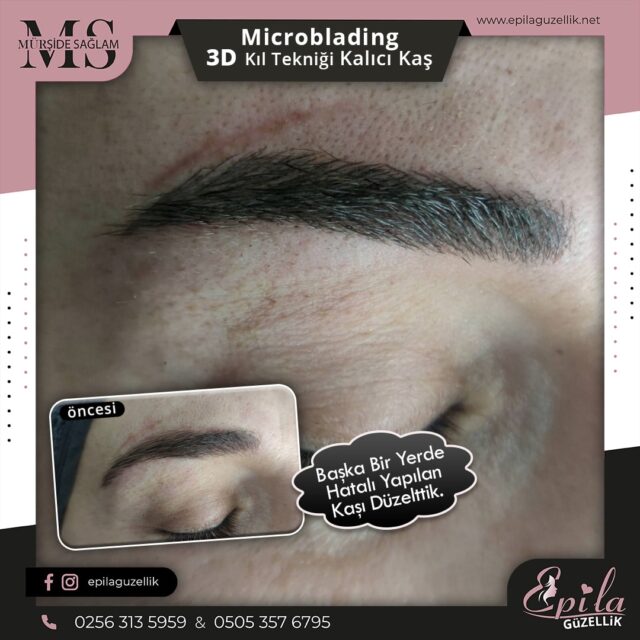 Nazilli - Microblading 3D Kıl Tekniği Kalıcı Kaş Kontürü